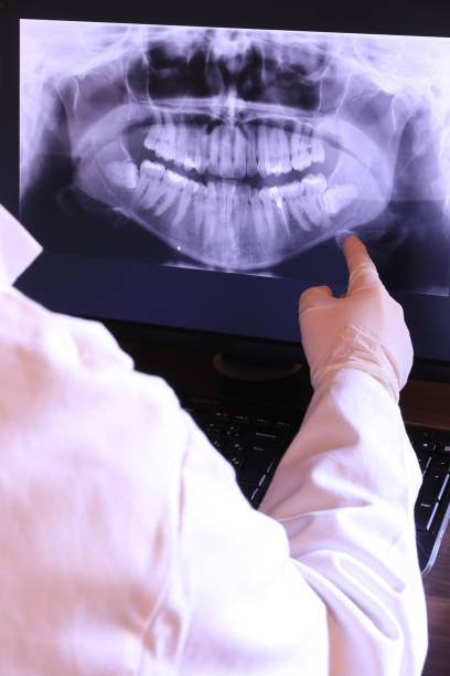 Best Emergency Treatment for Oral Infections in Harrogate, TN