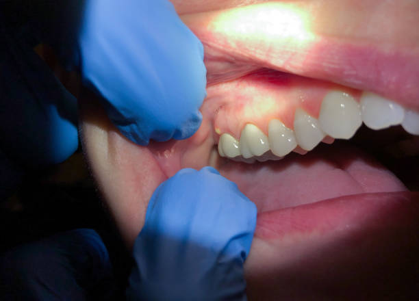 Best Emergency Root Canal Therapy in Harrogate, TN